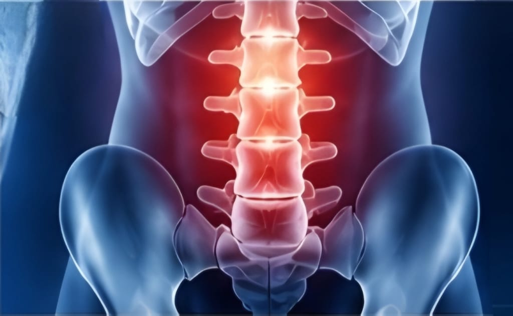 Spondyloarthritis Treatment